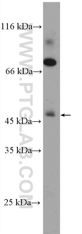 Western Blot (WB) analysis of human heart tissue using STARS/ABRA Polyclonal antibody (22673-1-AP)