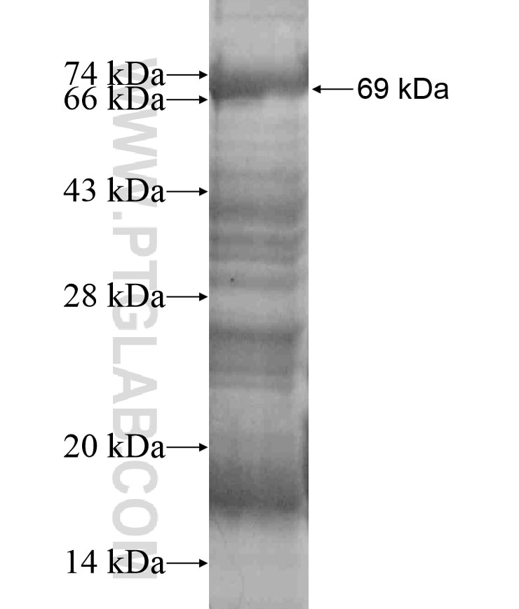 ABRA fusion protein Ag18456 SDS-PAGE