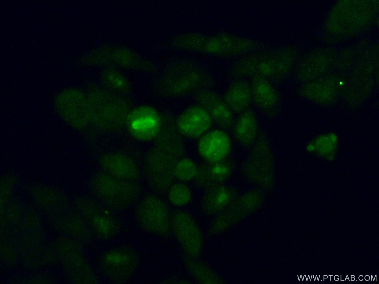 Immunofluorescence (IF) / fluorescent staining of HeLa cells using ABT1 Polyclonal antibody (14148-1-AP)