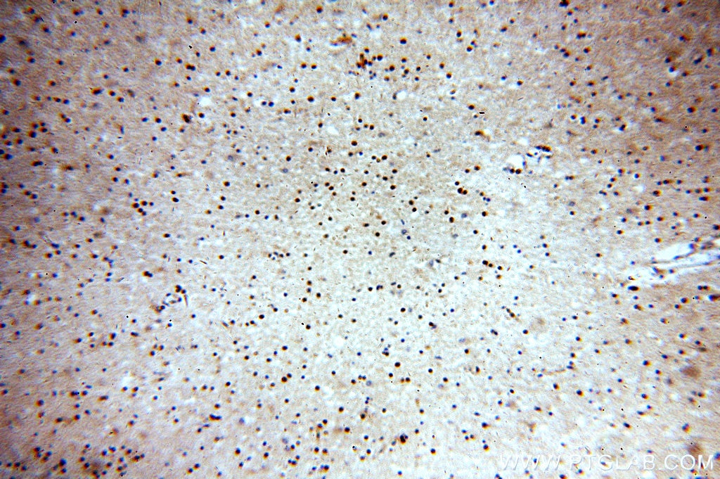 Immunohistochemistry (IHC) staining of human brain tissue using ABT1 Polyclonal antibody (14148-1-AP)