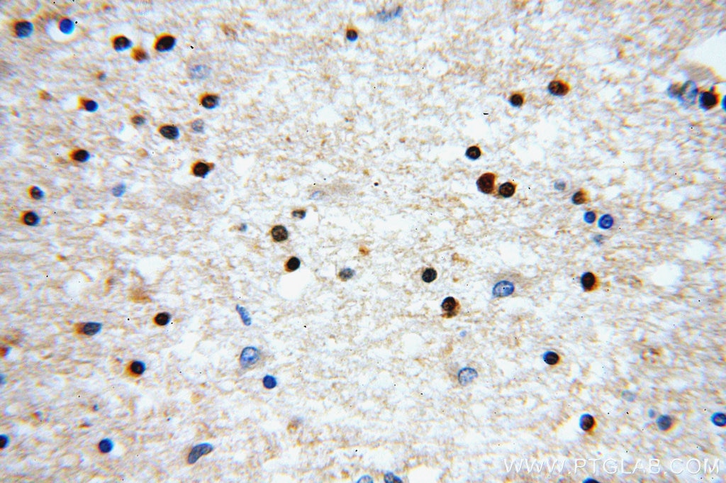 IHC staining of human brain using 14148-1-AP