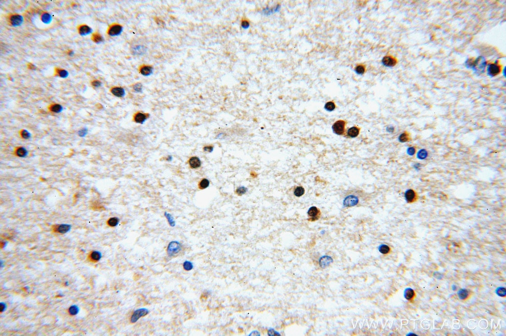 Immunohistochemistry (IHC) staining of human brain tissue using ABT1 Polyclonal antibody (14148-1-AP)