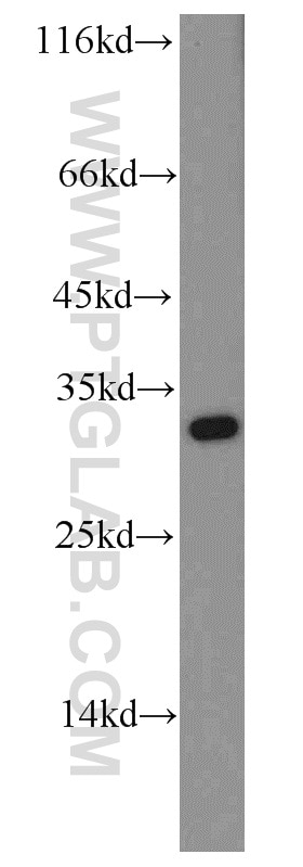 Western Blot (WB) analysis of HeLa cells using ABT1 Polyclonal antibody (14148-1-AP)