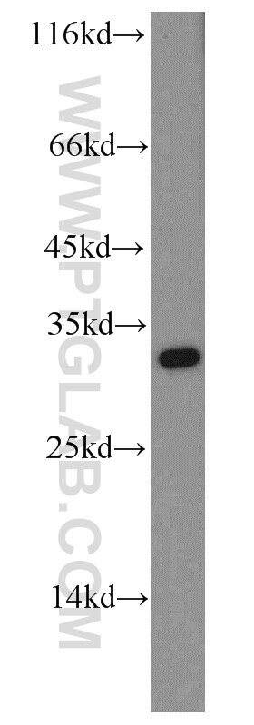 WB analysis of HeLa using 14148-1-AP