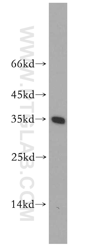 Western Blot (WB) analysis of mouse liver tissue using ABT1 Polyclonal antibody (14148-1-AP)