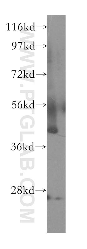 Western Blot (WB) analysis of human skeletal muscle tissue using ABTB1 Polyclonal antibody (11095-1-AP)