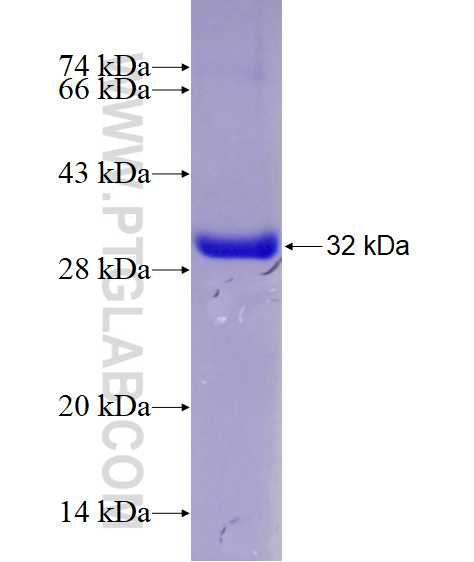ABTB1 fusion protein Ag28959 SDS-PAGE