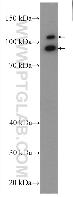 Western Blot (WB) analysis of HepG2 cells using ABTB2 Polyclonal antibody (24323-1-AP)