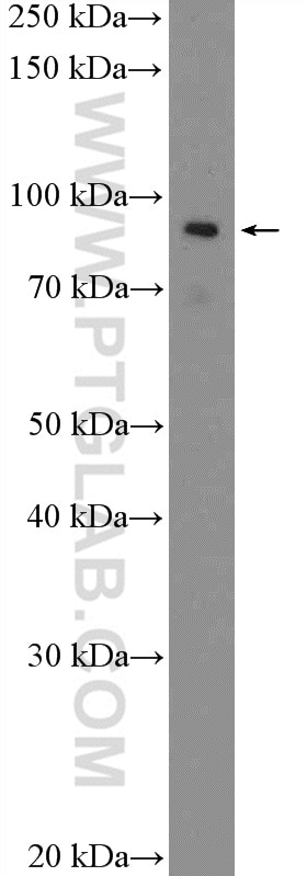 Western Blot (WB) analysis of K-562 cells using ABTB2 Polyclonal antibody (24323-1-AP)