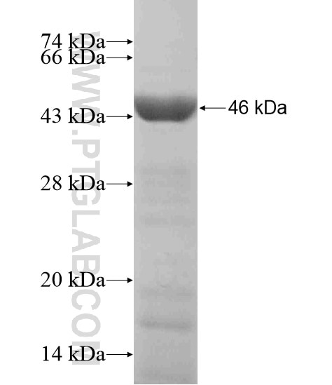ABTB2 fusion protein Ag19284 SDS-PAGE