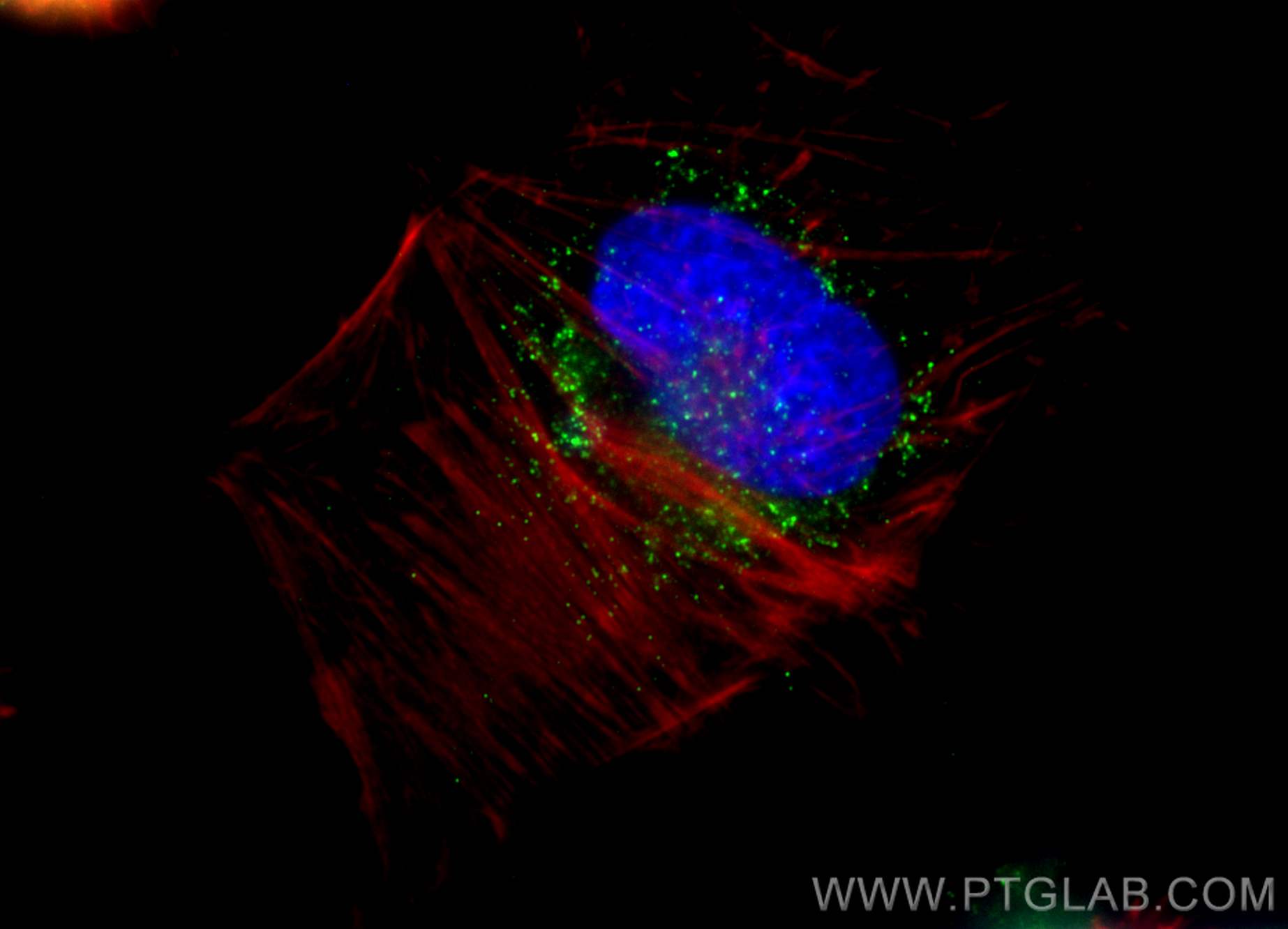 Immunofluorescence (IF) / fluorescent staining of U-251 cells using ACAA1 Polyclonal antibody (12319-2-AP)