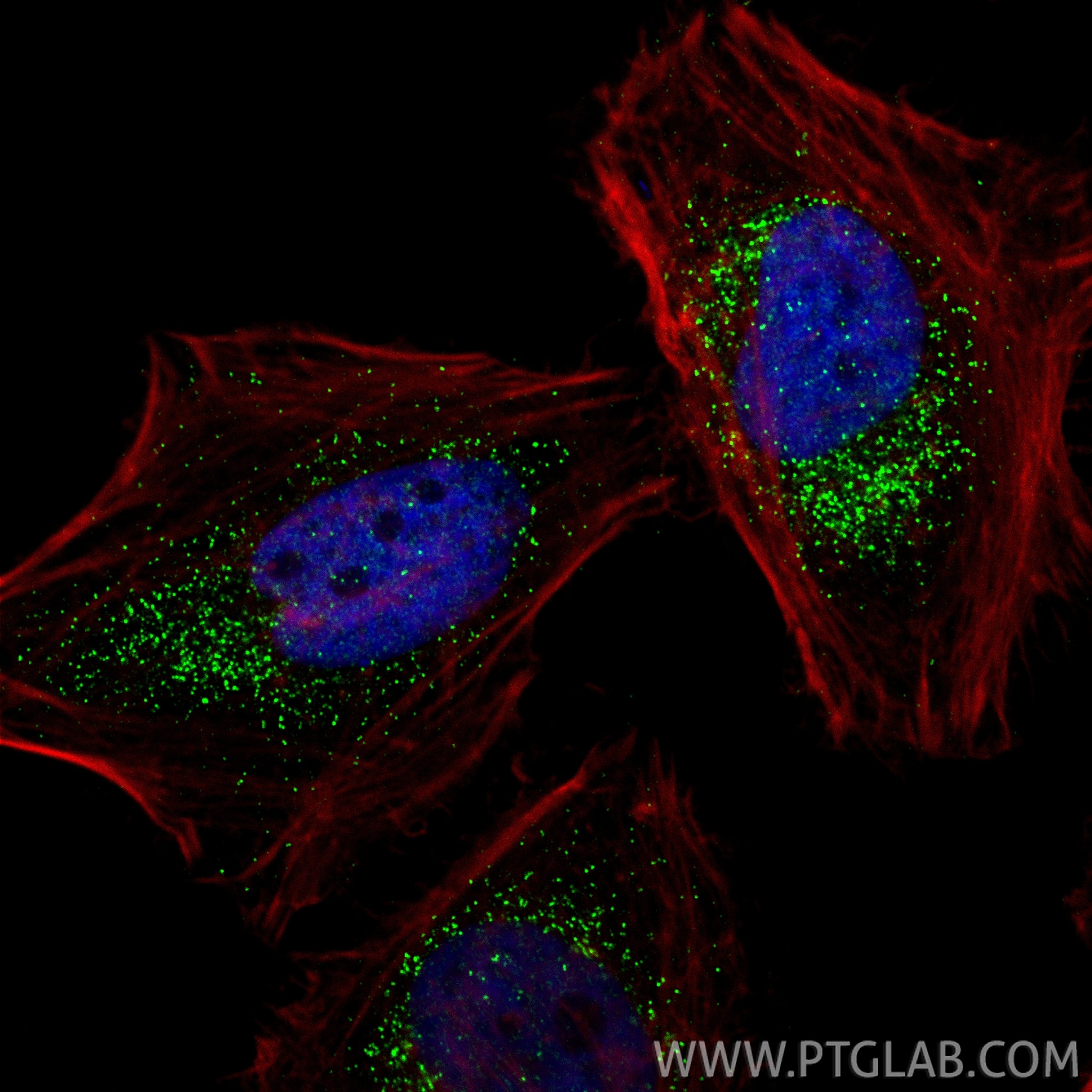 Immunofluorescence (IF) / fluorescent staining of HeLa cells using ACAA1 Polyclonal antibody (12319-2-AP)