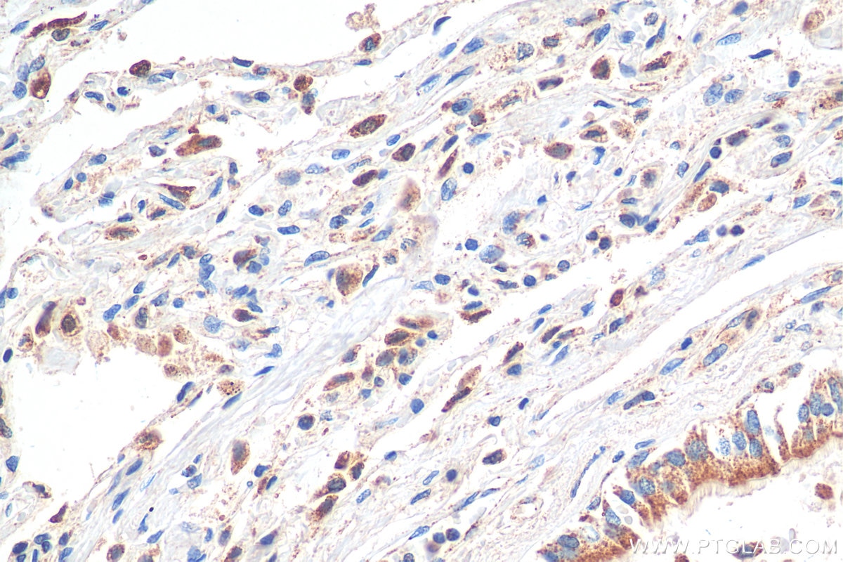Immunohistochemistry (IHC) staining of human lung tissue using ACAA1 Polyclonal antibody (12319-2-AP)