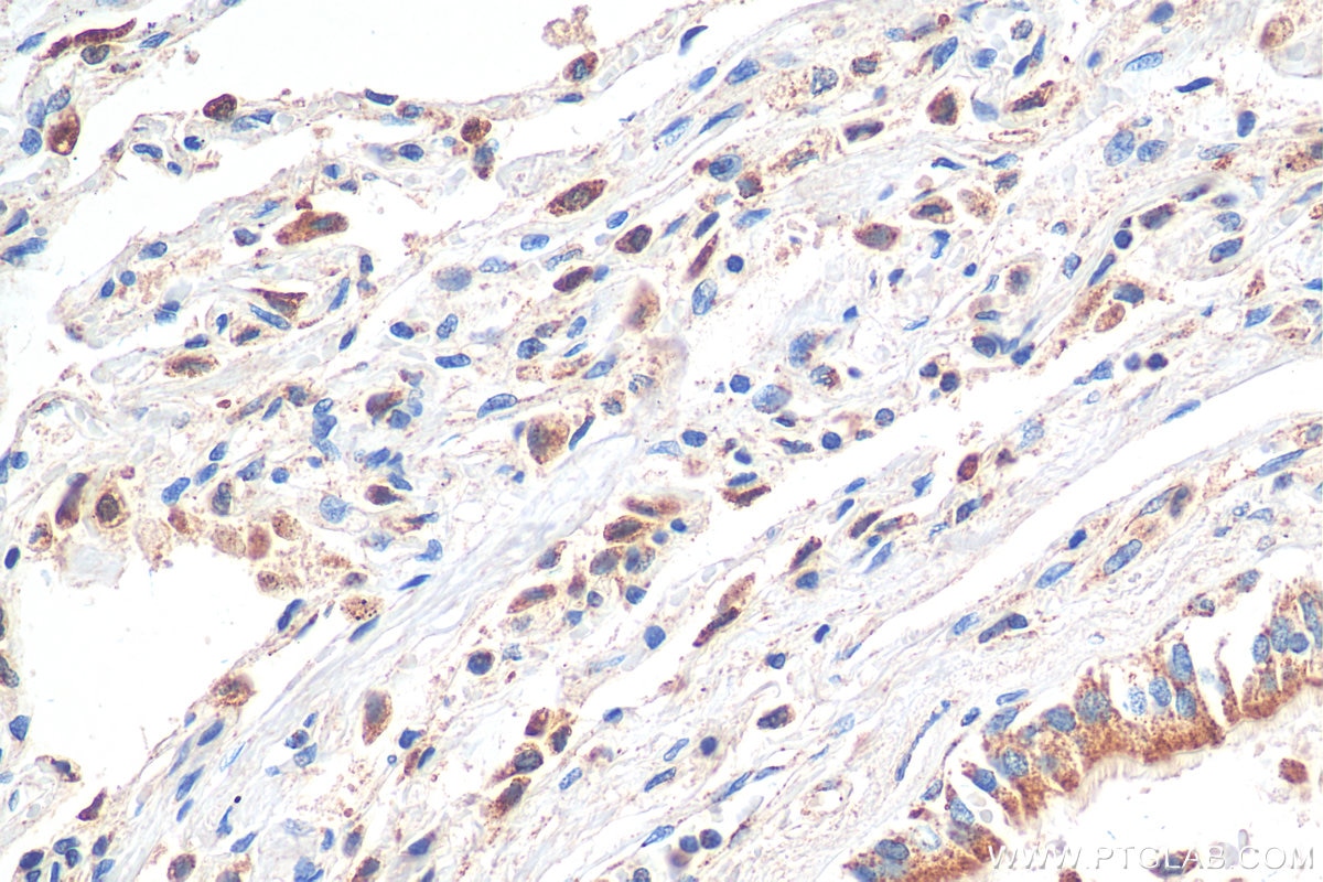 IHC staining of human lung using 12319-2-AP