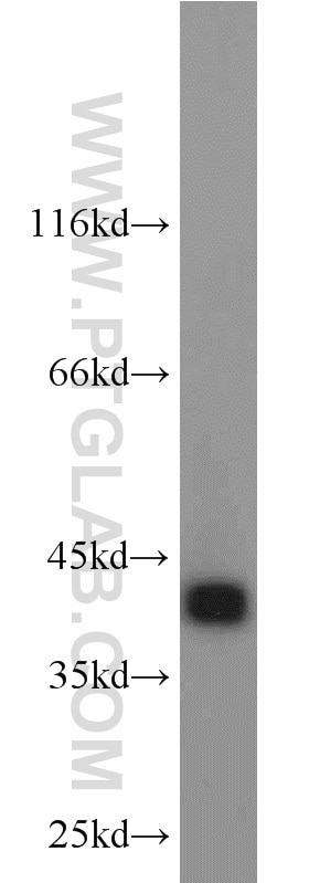 Western Blot (WB) analysis of L02 cells using ACAA1 Polyclonal antibody (12319-2-AP)