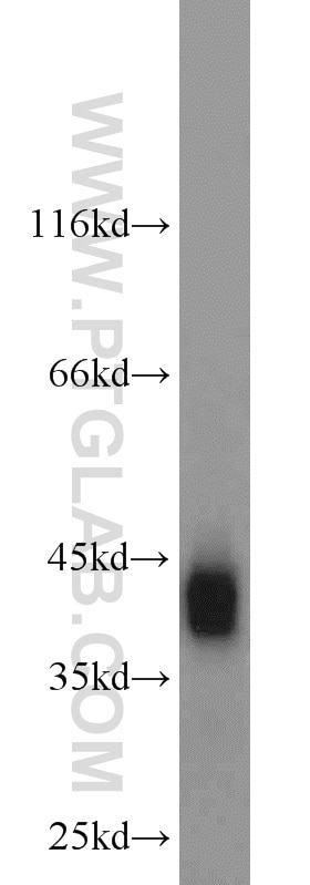 Western Blot (WB) analysis of A549 cells using ACAA1 Polyclonal antibody (12319-2-AP)