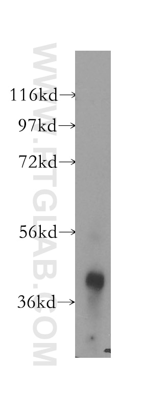 Western Blot (WB) analysis of human lung tissue using ACAA1 Polyclonal antibody (12319-2-AP)