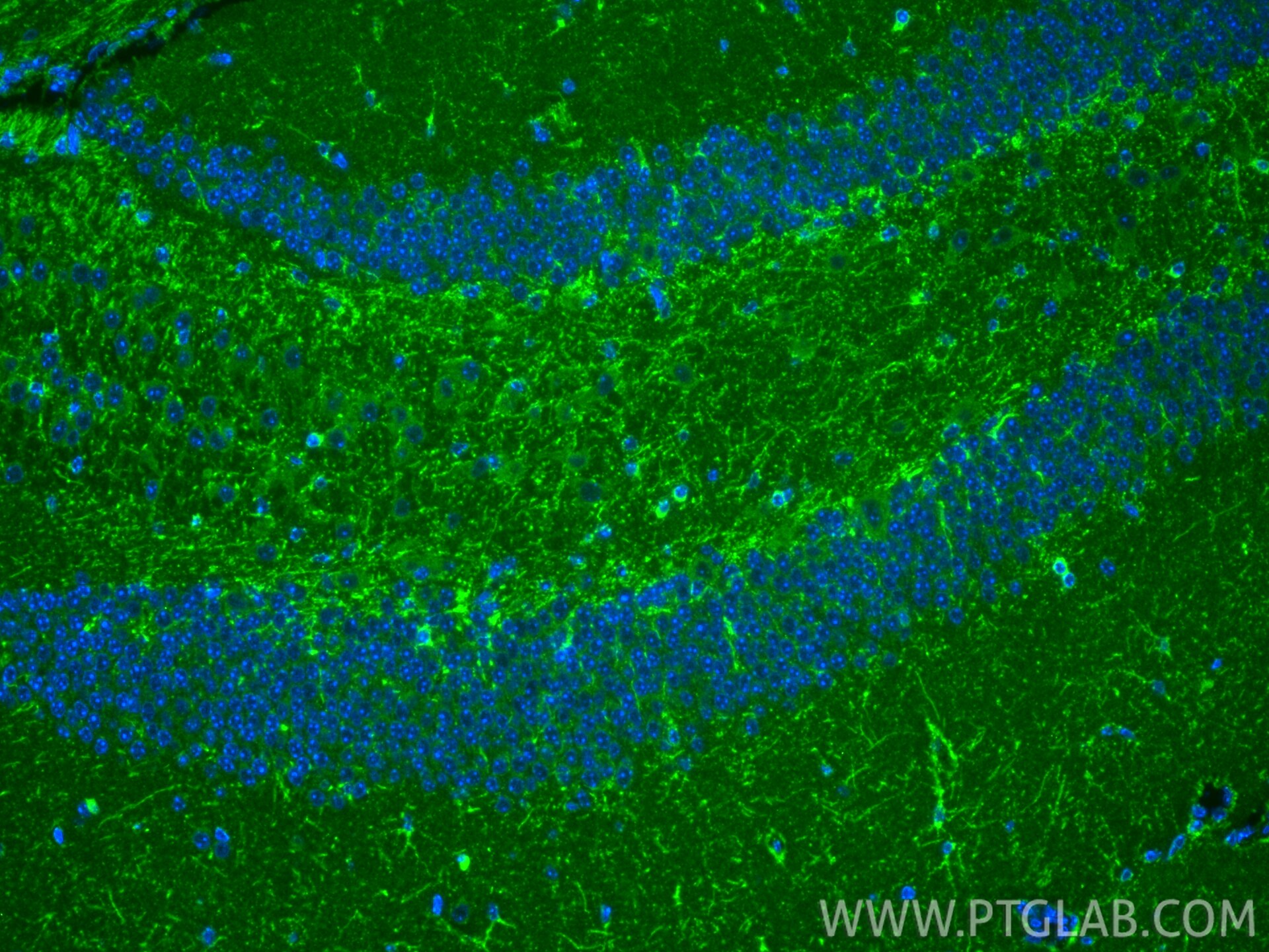 IF Staining of mouse brain using 87969-1-RR (same clone as 87969-1-PBS) Immunofluorescence (IF) / fluorescent staining of mouse brain tissue using ACAA1 Recombinant monoclonal antibody (87969-1-RR)