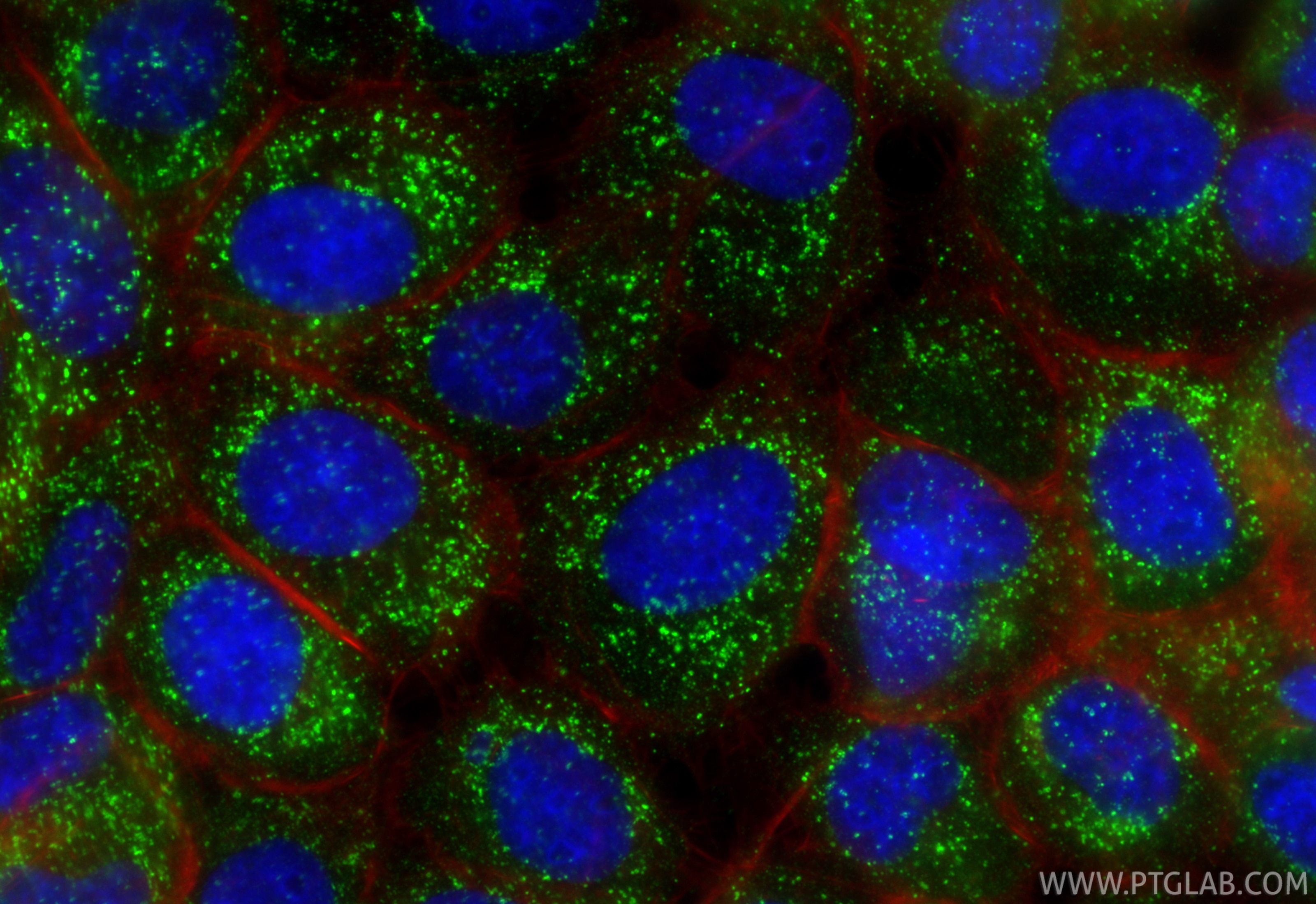 IF Staining of U-251 using 87969-1-RR (same clone as 87969-1-PBS) Immunofluorescence (IF) / fluorescent staining of U-251 cells using ACAA1 Recombinant monoclonal antibody (87969-1-RR)