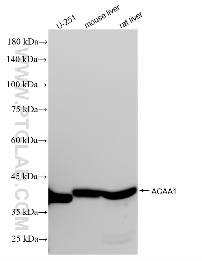 WB analysis using 87969-1-RR (same clone as 87969-1-PBS) Western Blot (WB) analysis of various lysates using ACAA1 Recombinant monoclonal antibody (87969-1-RR)