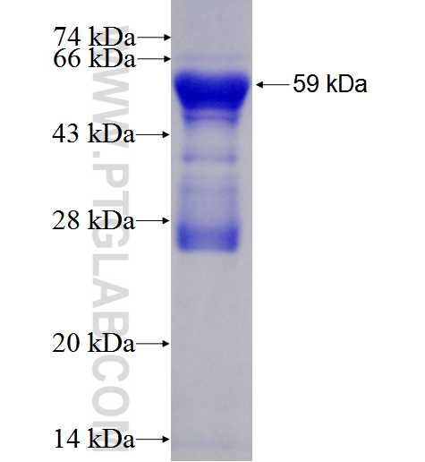 ACAA1 fusion protein Ag2972 SDS-PAGE