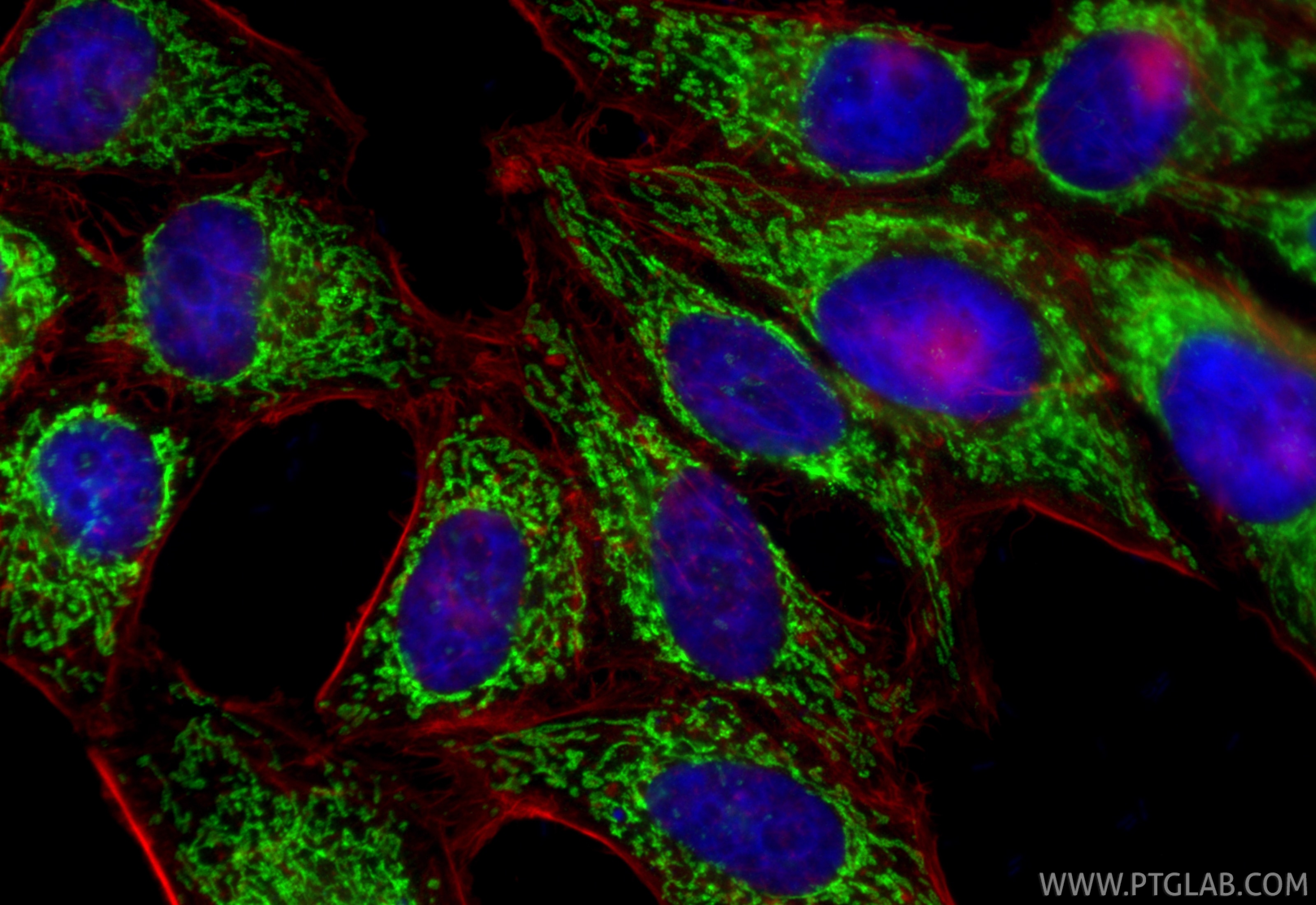 Immunofluorescence (IF) / fluorescent staining of HepG2 cells using ACAA2 Polyclonal antibody (11111-1-AP)