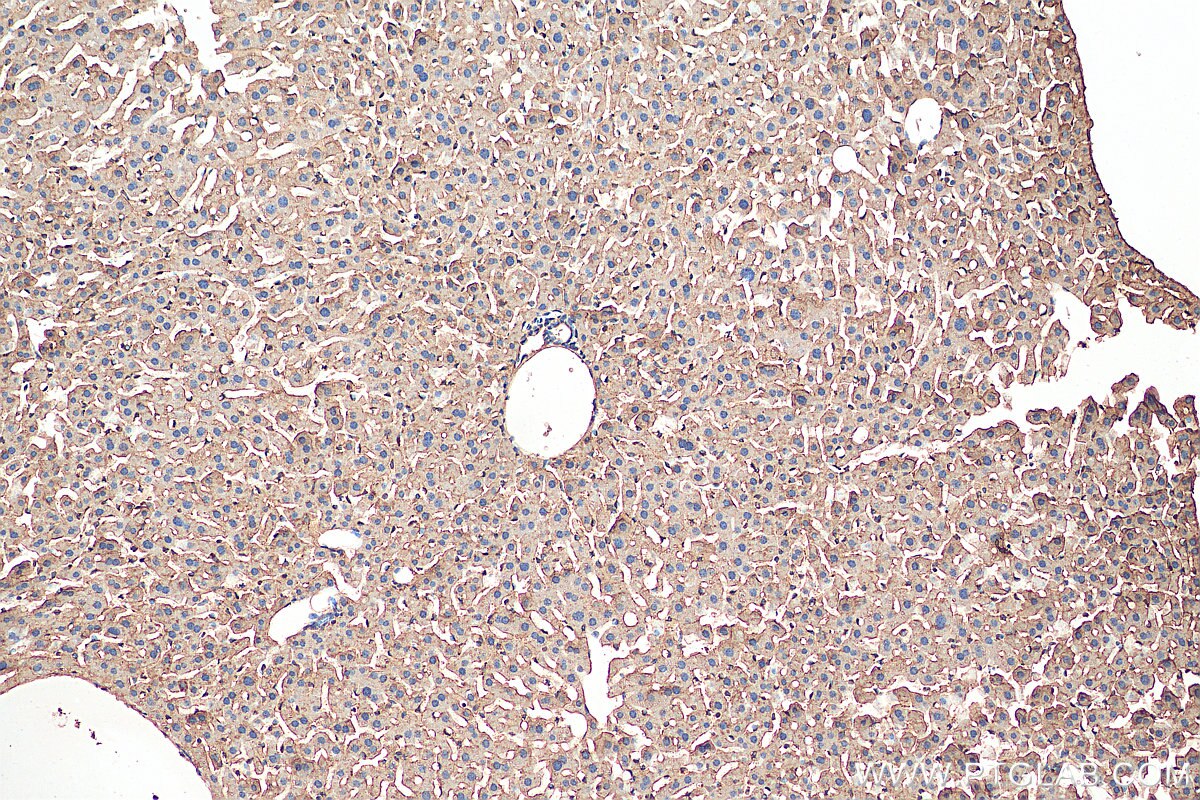 Immunohistochemistry (IHC) staining of mouse liver tissue using ACAA2 Polyclonal antibody (11111-1-AP)