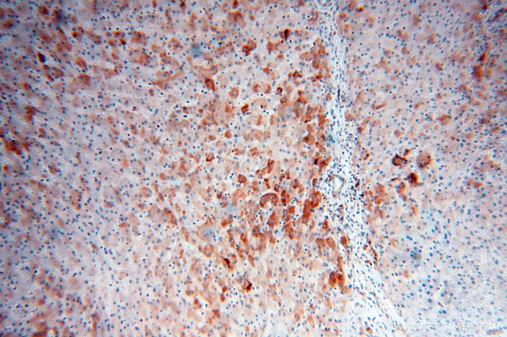 Immunohistochemistry (IHC) staining of human liver tissue using ACAA2 Polyclonal antibody (11111-1-AP)
