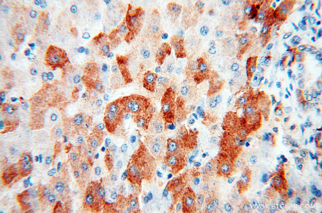 Immunohistochemistry (IHC) staining of human liver tissue using ACAA2 Polyclonal antibody (11111-1-AP)