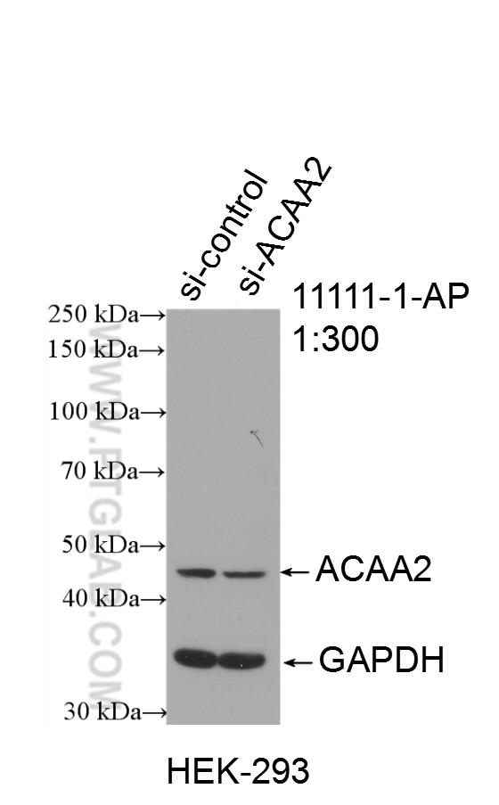 Western Blot (WB) analysis of HEK-293 cells using ACAA2 Polyclonal antibody (11111-1-AP)