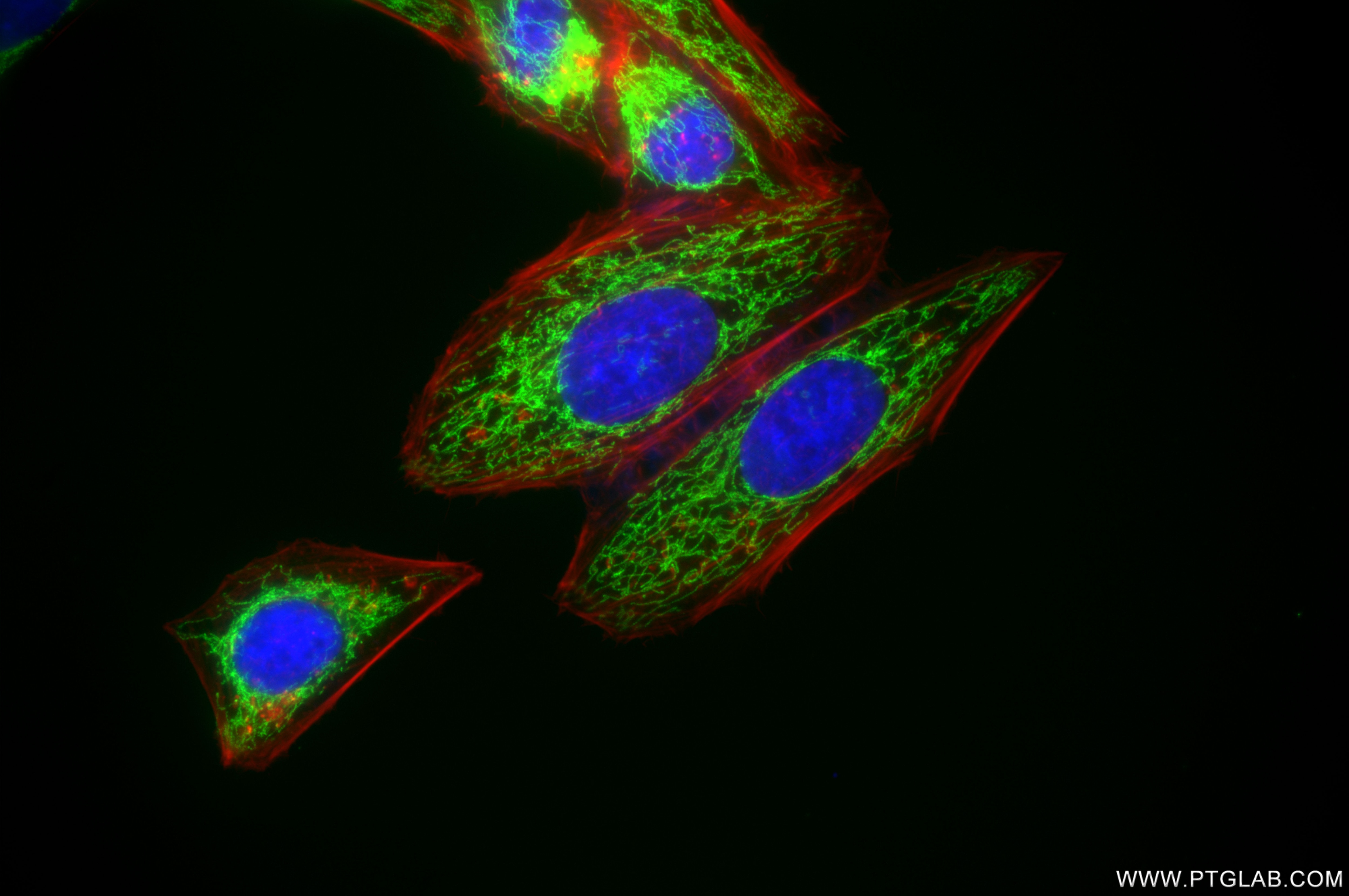 Immunofluorescence (IF) / fluorescent staining of HepG2 cells using ACAA2 Recombinant antibody (86161-3-RR)