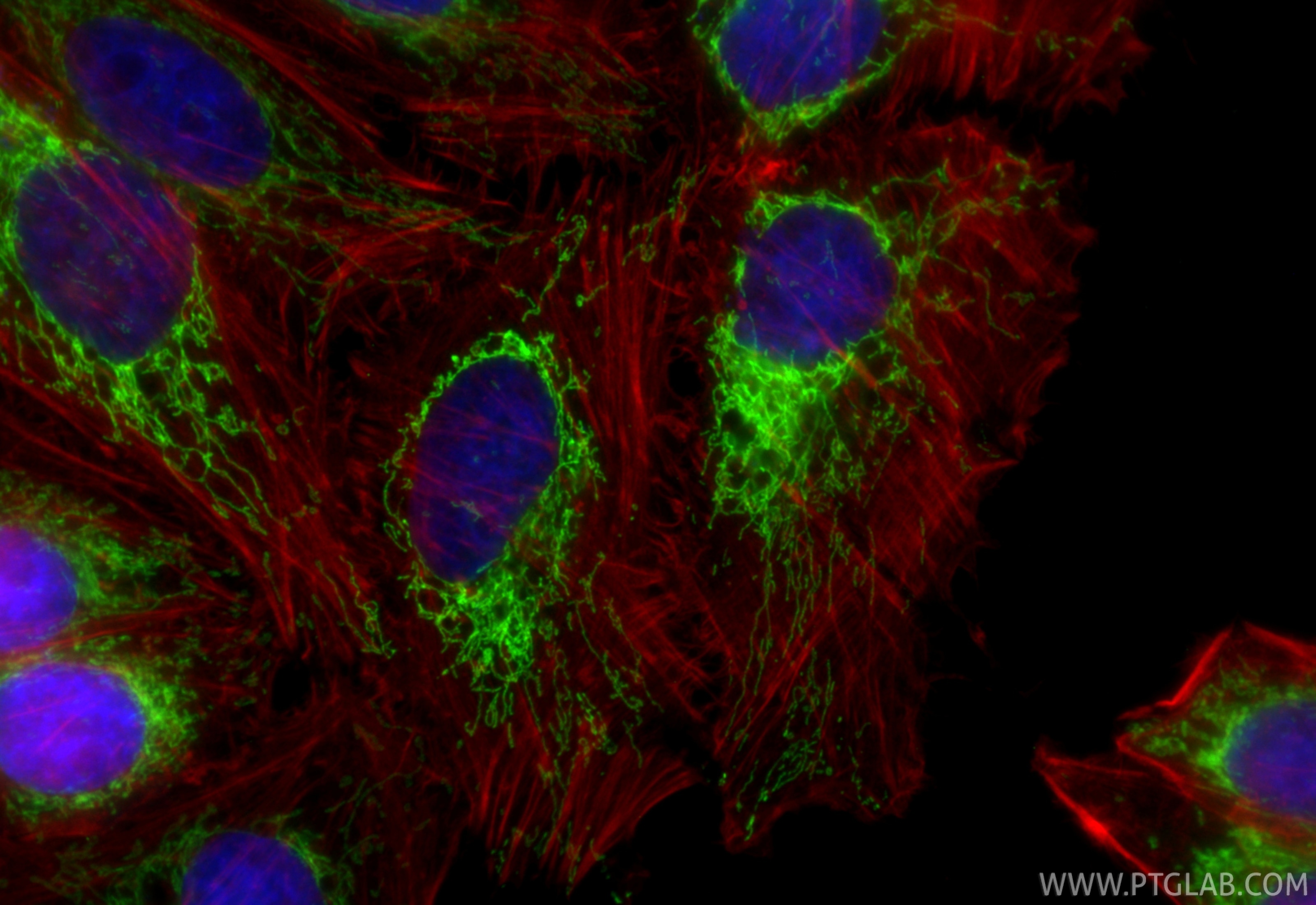 Immunofluorescence (IF) / fluorescent staining of HepG2 cells using CoraLite® Plus 488-conjugated ACAA2 Recombinant mo (CL488-86161-3)