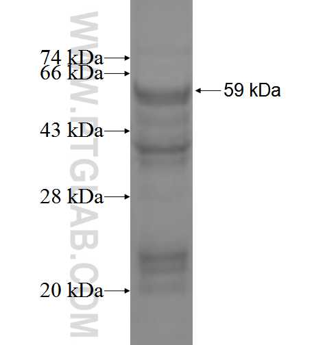 ACAA2 fusion protein Ag1609 SDS-PAGE
