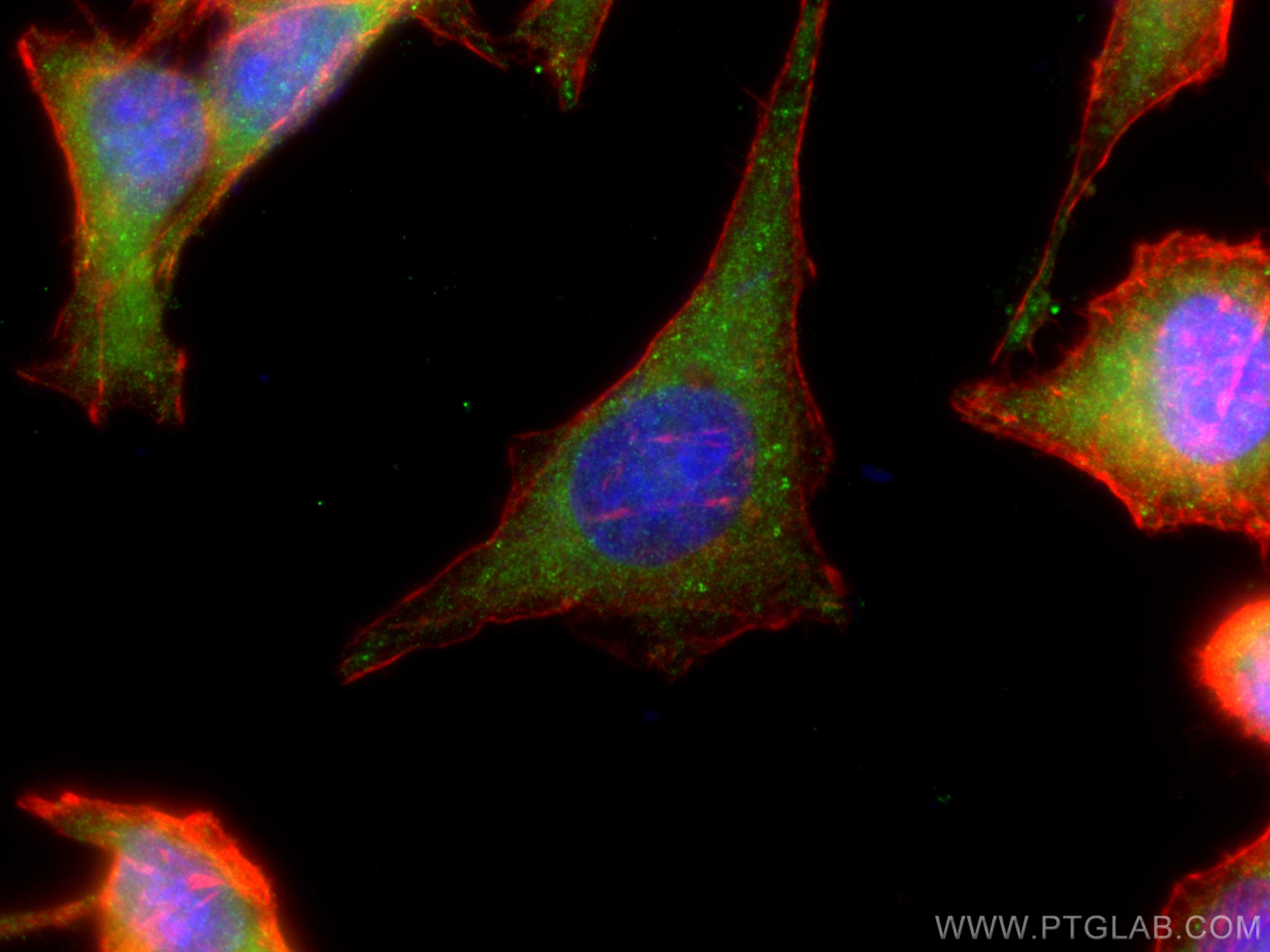 Immunofluorescence (IF) / fluorescent staining of HeLa cells using ACC1 Polyclonal antibody (21923-1-AP)