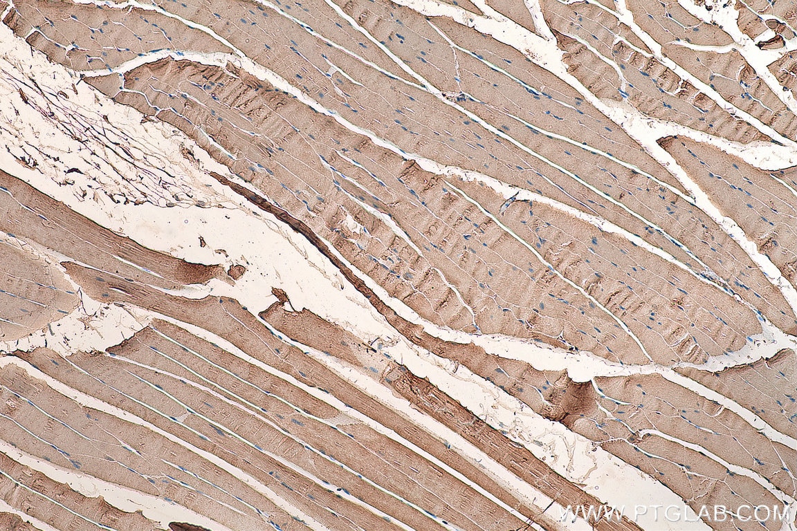 Immunohistochemistry (IHC) staining of mouse skeletal muscle tissue using ACC1 Polyclonal antibody (21923-1-AP)