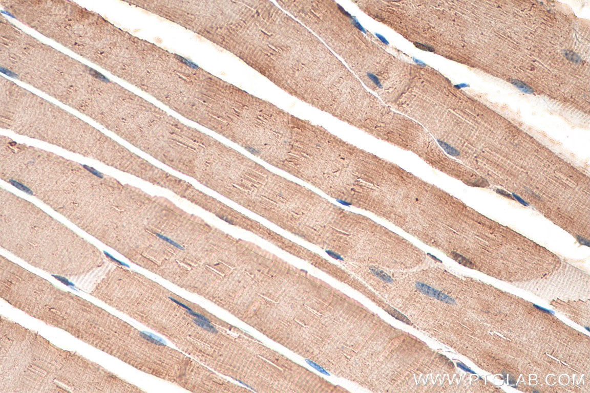 Immunohistochemistry (IHC) staining of mouse skeletal muscle tissue using ACC1 Polyclonal antibody (21923-1-AP)