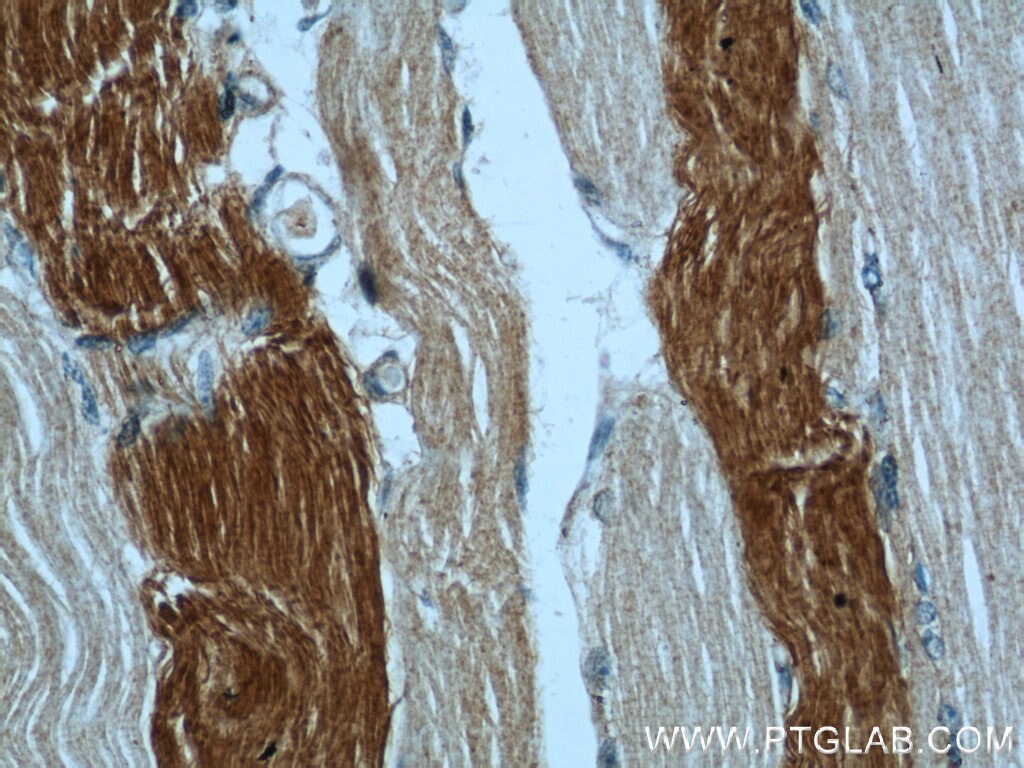 IHC staining of human skeletal muscle using 21923-1-AP