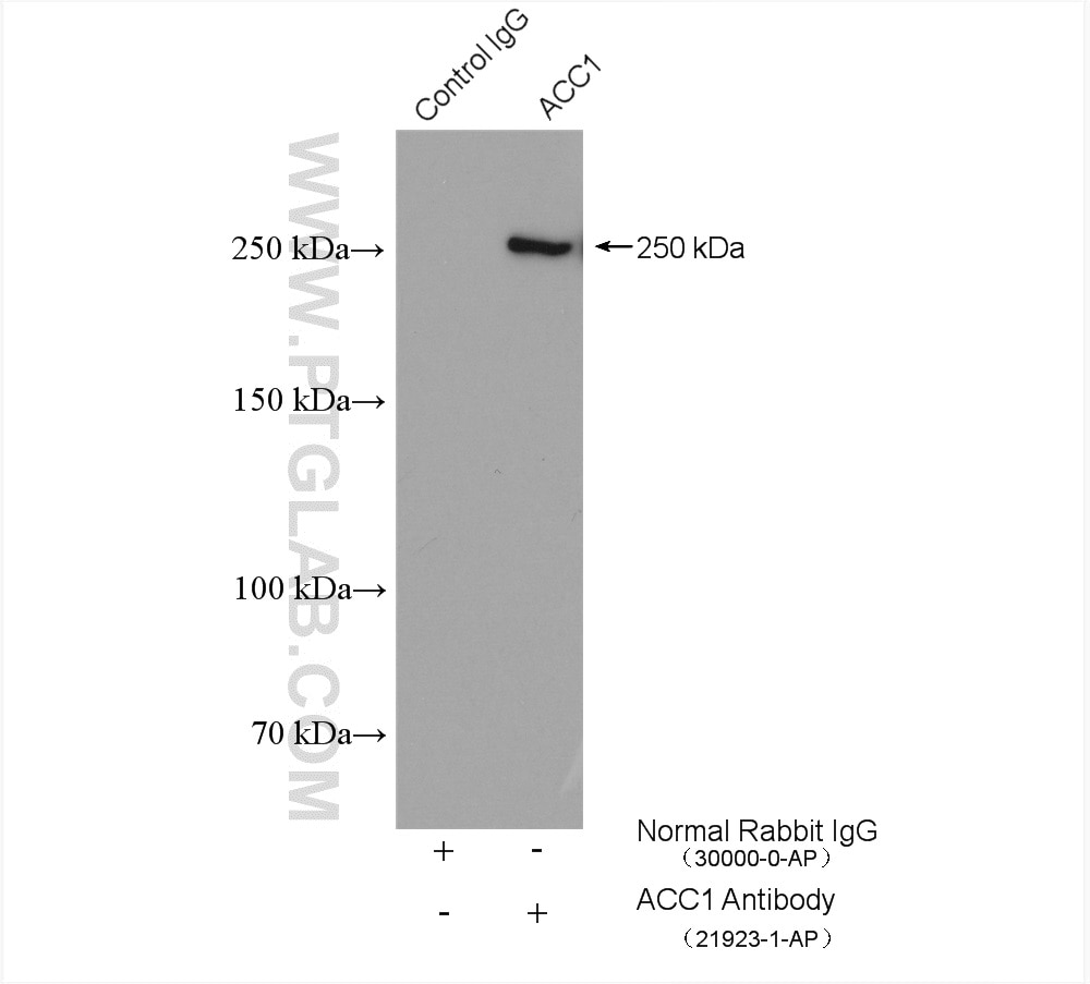 Immunoprecipitation (IP) experiment of HepG2 cells using ACC1 Polyclonal antibody (21923-1-AP)