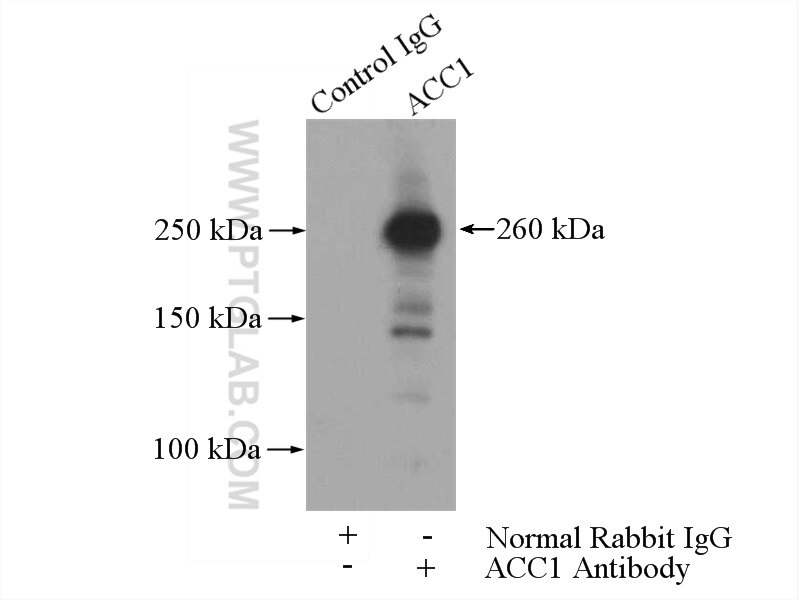 Immunoprecipitation (IP) experiment of HeLa cells using ACC1 Polyclonal antibody (21923-1-AP)