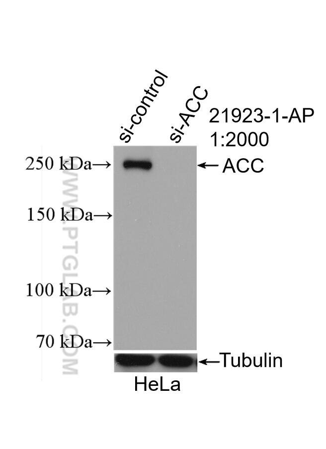 Western Blot (WB) analysis of HeLa cells using ACC1 Polyclonal antibody (21923-1-AP)