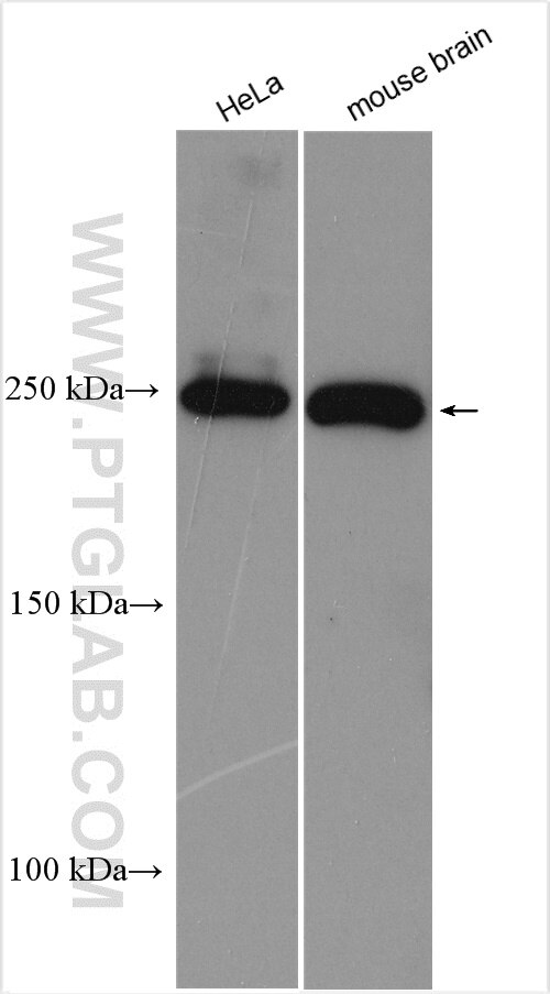 Western Blot (WB) analysis of various lysates using ACC1 Polyclonal antibody (21923-1-AP)