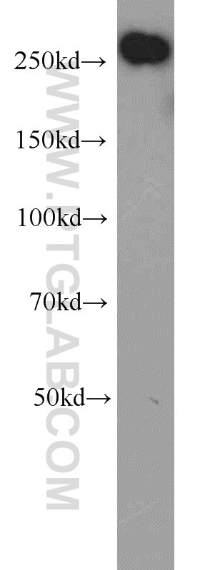 ACC1 Polyclonal antibody