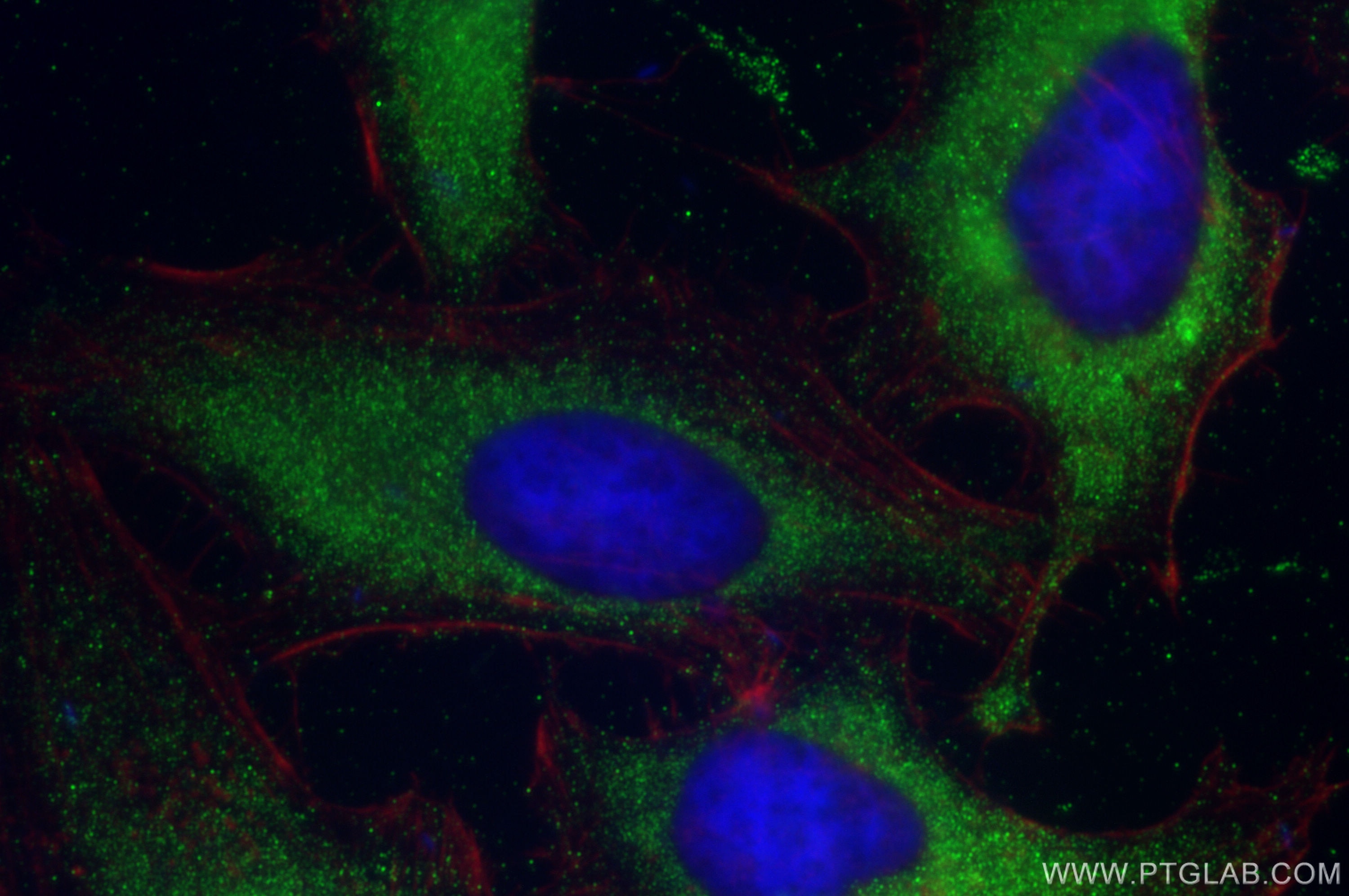 Immunofluorescence (IF) / fluorescent staining of HeLa cells using ACAD10 Polyclonal antibody (17161-1-AP)