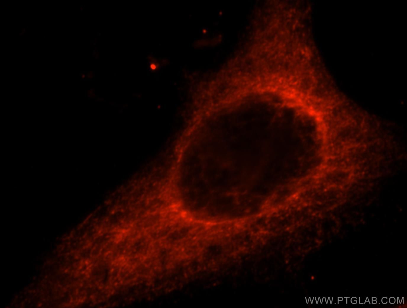 Immunofluorescence (IF) / fluorescent staining of HeLa cells using ACAD10 Polyclonal antibody (17161-1-AP)