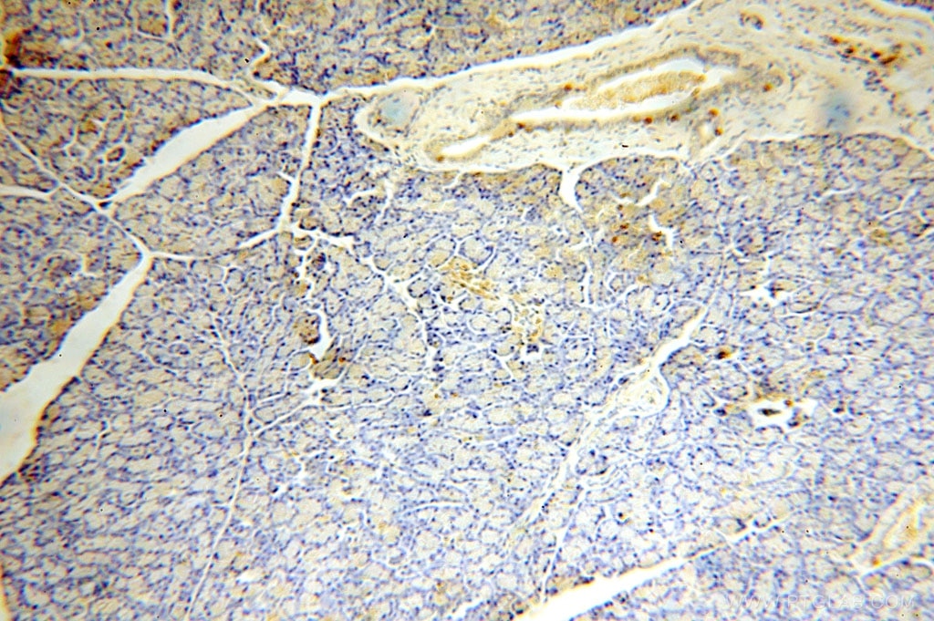 IHC staining of human pancreas using 17161-1-AP