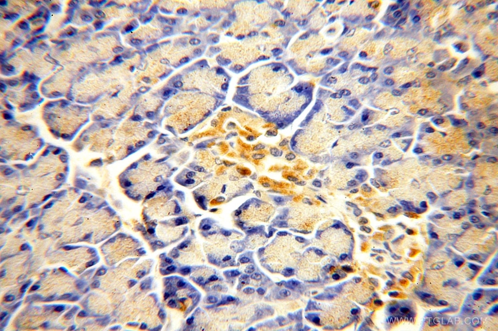 Immunohistochemistry (IHC) staining of human pancreas tissue using ACAD10 Polyclonal antibody (17161-1-AP)