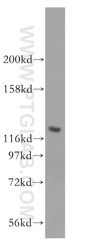 Western Blot (WB) analysis of mouse spleen tissue using ACAD10 Polyclonal antibody (17161-1-AP)