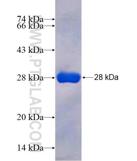ACAD10 fusion protein Ag10510 SDS-PAGE