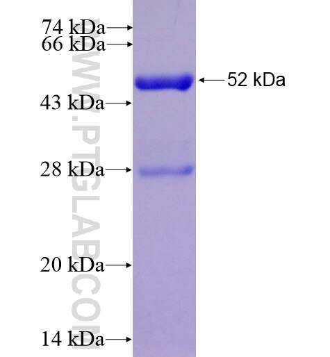 ACAD10 fusion protein Ag10529 SDS-PAGE