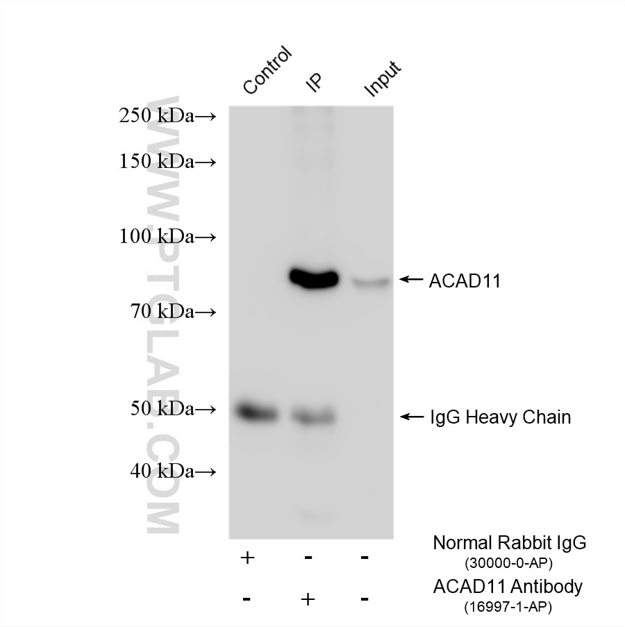 Immunoprecipitation (IP) experiment of mouse kidney tissue using ACAD11 Polyclonal antibody (16997-1-AP)